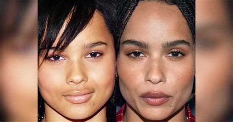 zoe kravitz plastic surgery|Zoe Kravitz Plastic Surgery: Shocking Before and After Look!